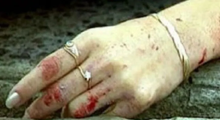 Raso mata su pareja Yesenia Altagracia Gutiérrez, de un disparo