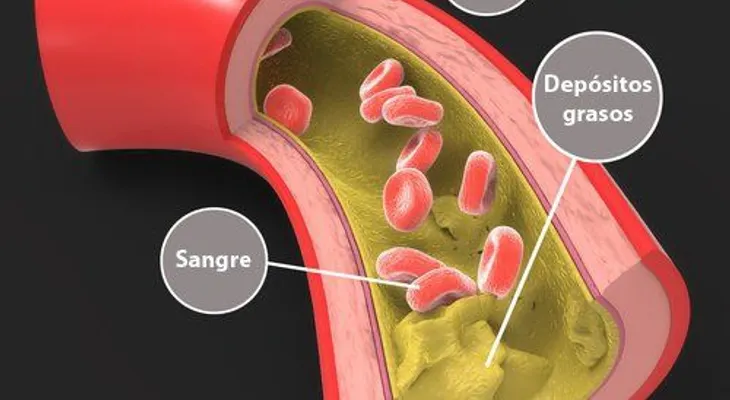Cómo bajar los triglicéridos de forma natural