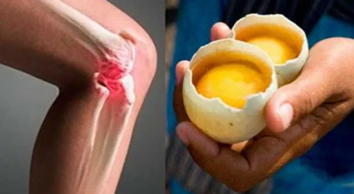Aprende cómo utilizar 2 huevos para el dolor de rodillas y reparar las articulaciones