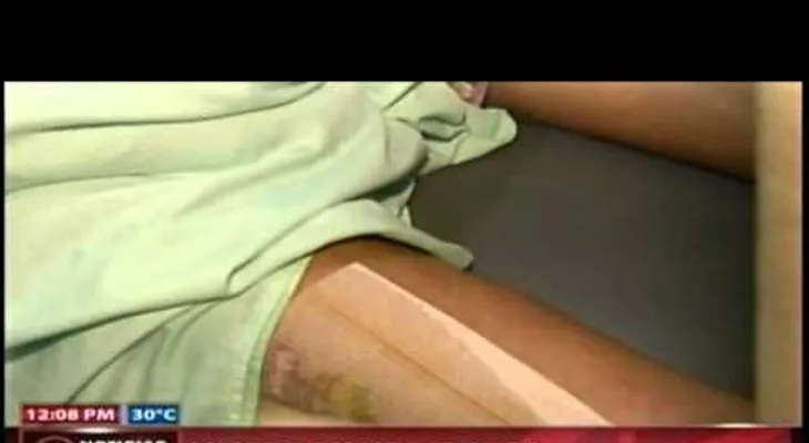 Fallece mujer obesa que estuvo interna en emergencias por falta de una cama