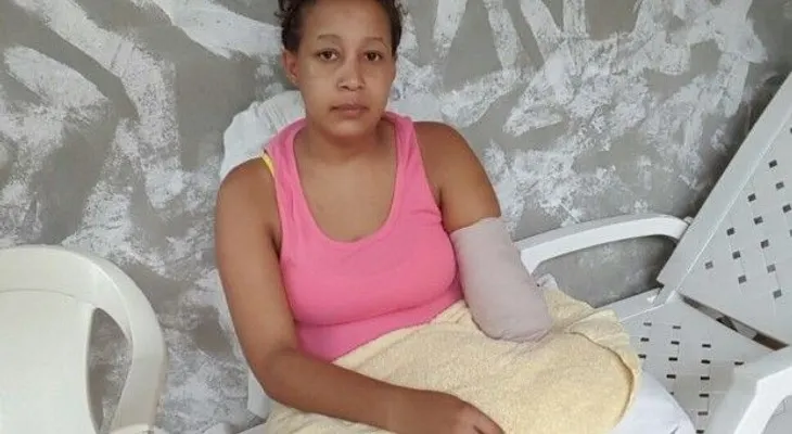 Apresan hombre cercenó brazo a su expareja			