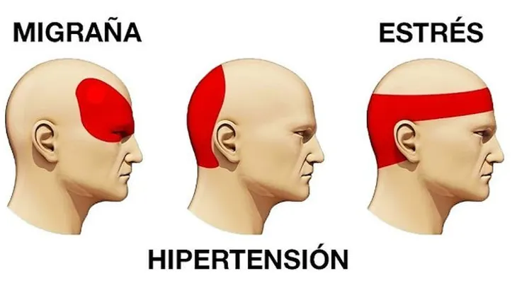 Esto calma cualquier dolor de cabeza por fuerte que sea en 6 minutos sin medicamentos