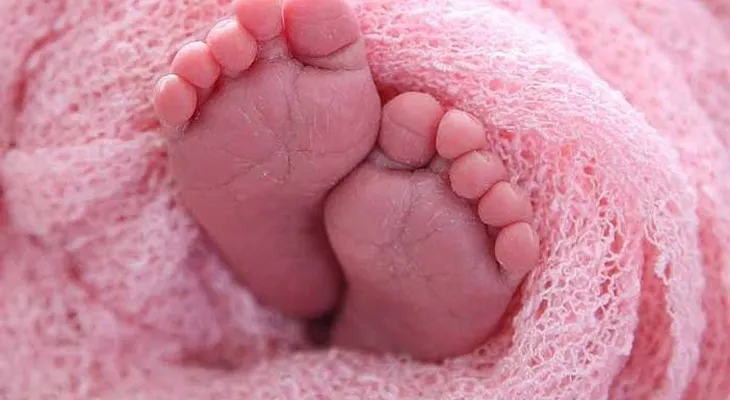 Nace una bebé con el corazón fuera del tórax en Bolivia