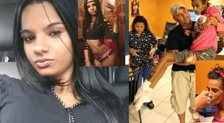 Así quedó esta jovencita luego de una cirugía de aumento de seno