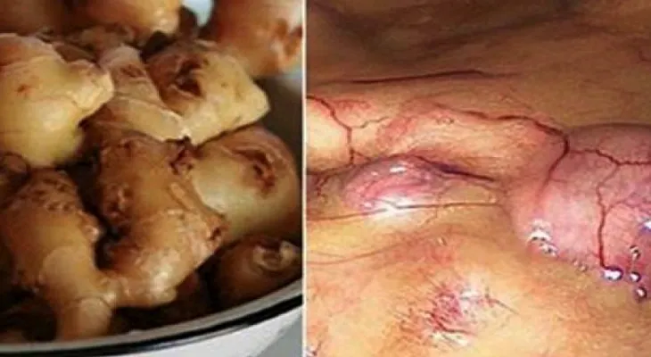 Esto le pasa a tu cuerpo si si come jengibre 30 días